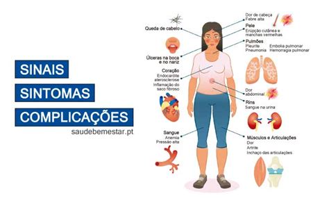 Lúpus: o que é, sintomas e como conviver com a doença